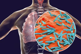 Infographic image of TB bacteria in human lung